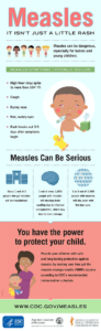 Measles Hamilton County Public Health