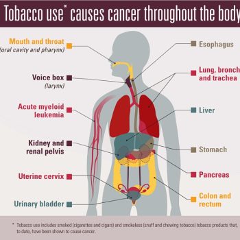 Image of all the places in the body cancer can develop in people who smoke tobacco. Source: CDC